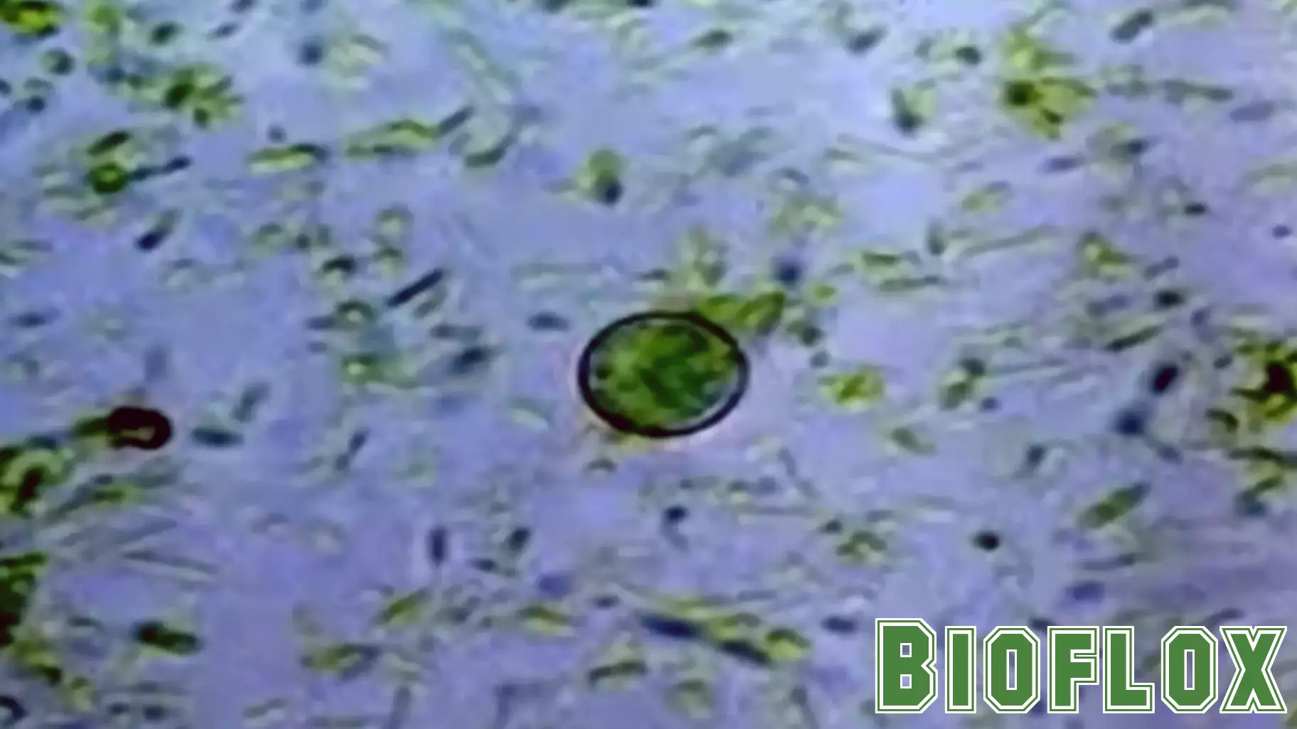 More than 60 North Carolina cases tied to parasite behind 'explosive diarrhea'