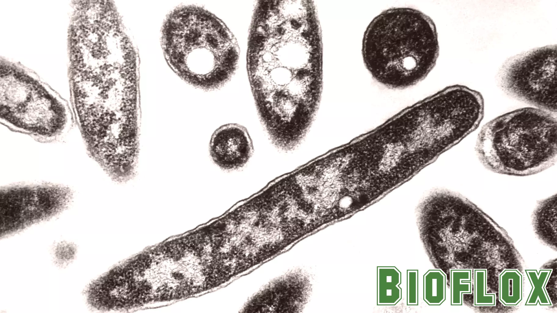 Second death reported in Legionnaires’ disease outbreak in New York City