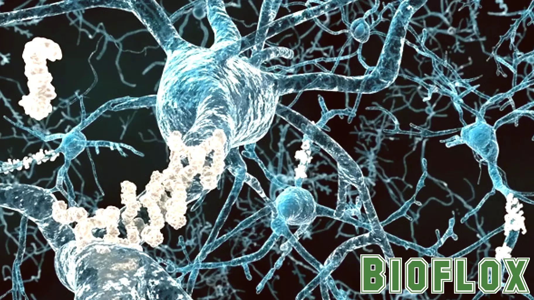 Understanding the Health Economics of Alzheimer’s Disease and Dementias