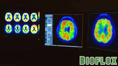 Exploring the Connection Between Creatine and Alzheimer's Disease