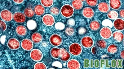 Health advisory issued: NYC reports first case of Mpox Clade I