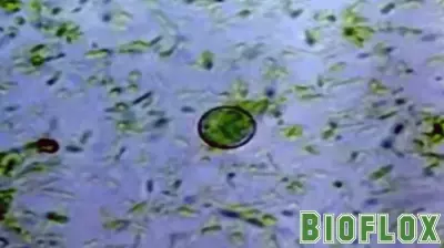 More than 60 North Carolina cases tied to parasite behind 'explosive diarrhea'